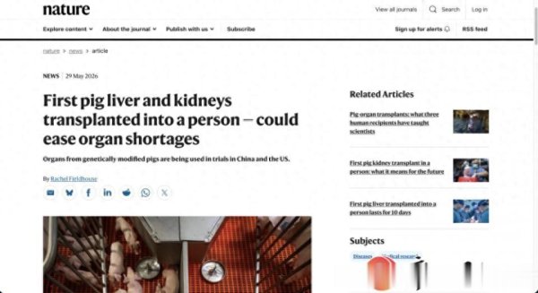 kaiyun(中国)2026世界杯官方网站 巨匠首例! 中国医师把基因裁剪猪的“全肝+双肾”移植脑圆寂患者
